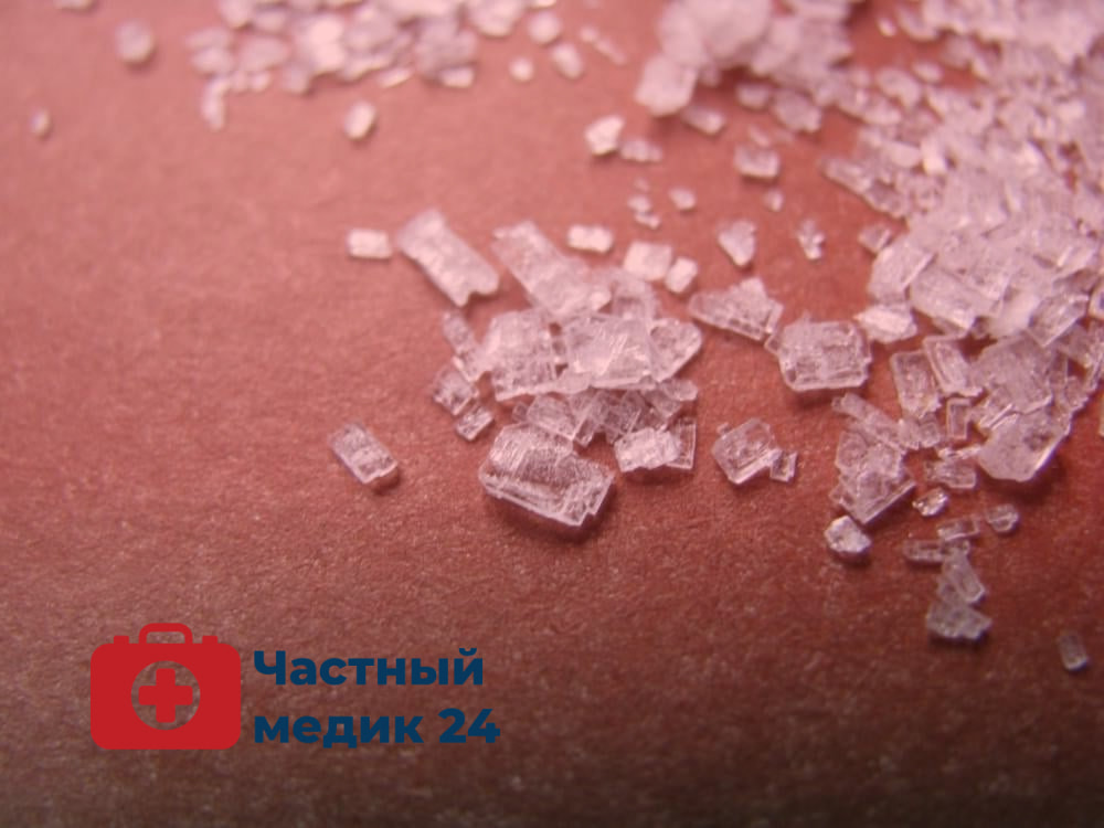 Препарат Меткатинон